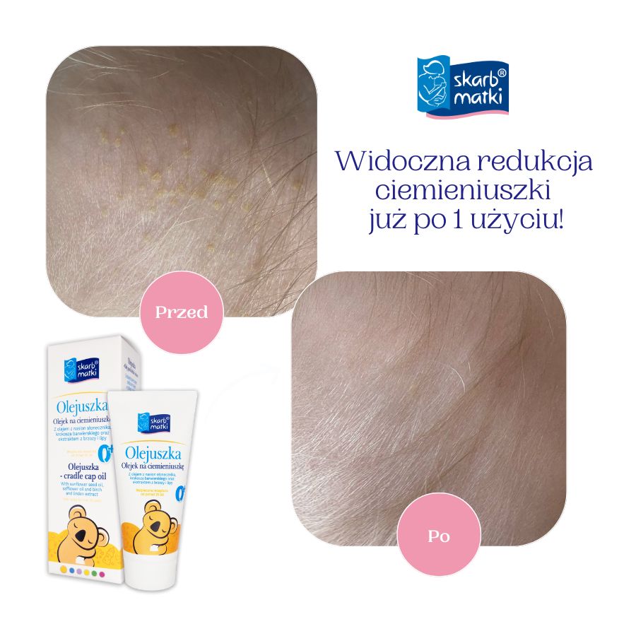 Olejuszka olejek na ciemieniuszkę 30 ml / Skarb Matki