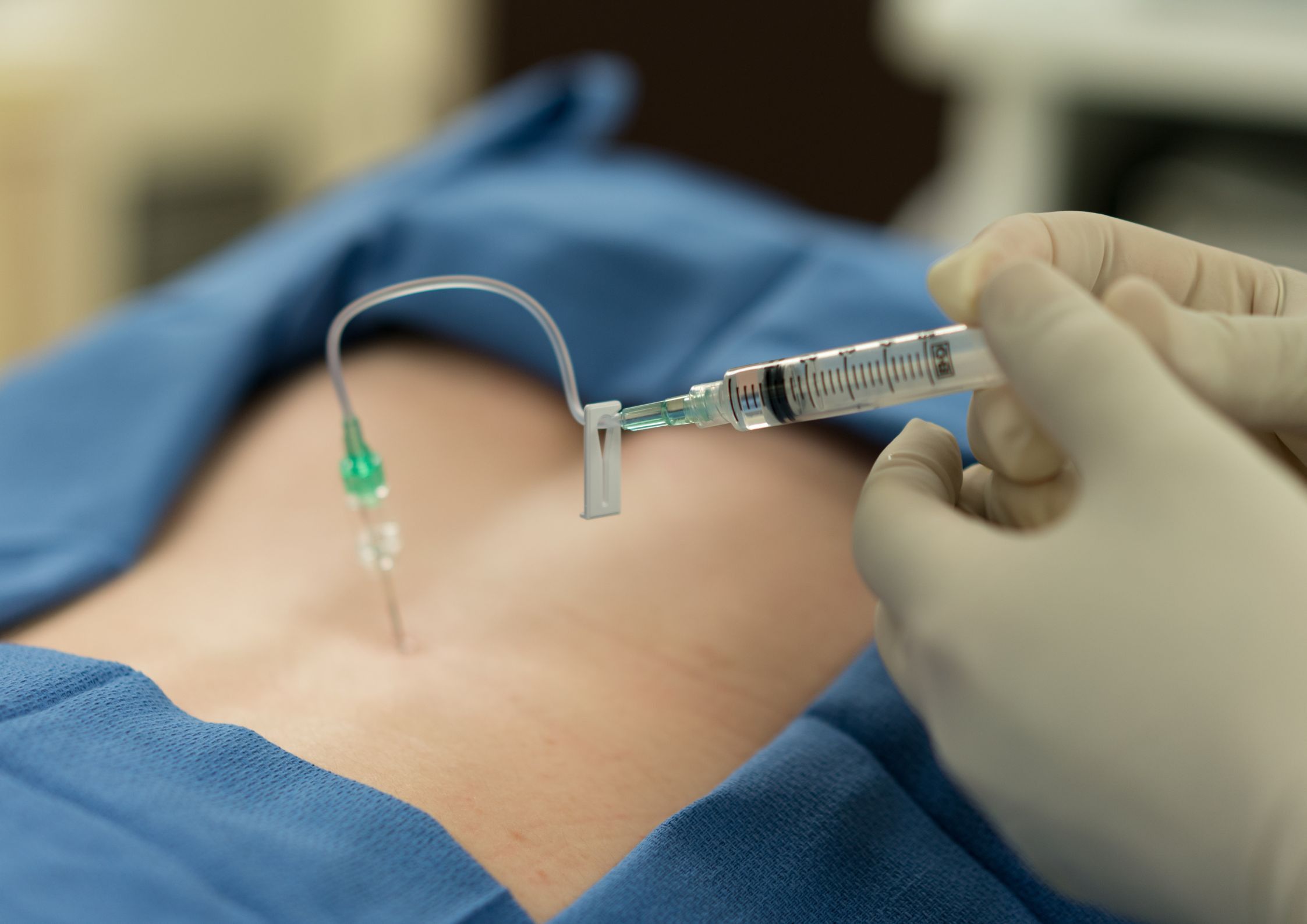 Fakty i mity na temat epiduralu i innych metod łagodzenia bólu porodowego